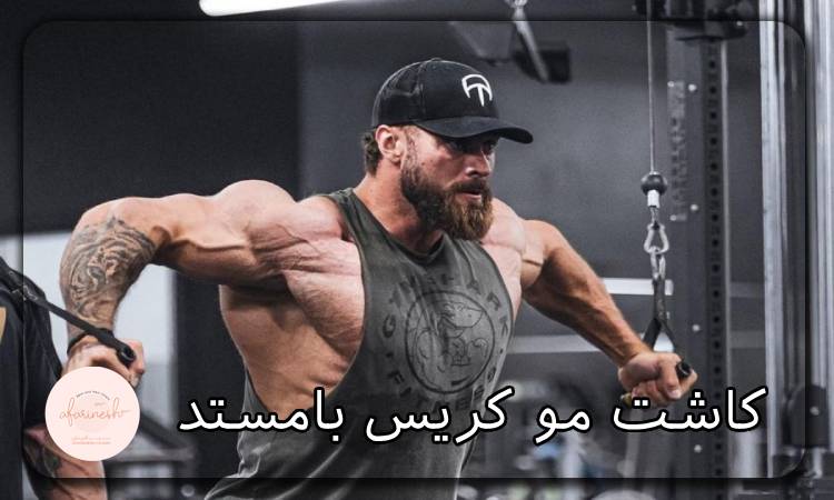 کاشت مو کریس بامستد