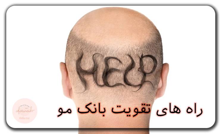 راه های تقویت بانک مو