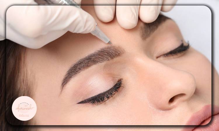 میکروبلیدینگ چیست؟