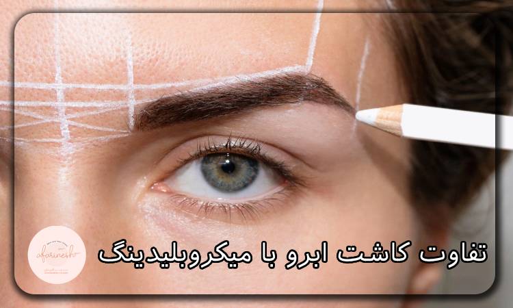 تفاوت کاشت ابرو با میکروبلیدینگ