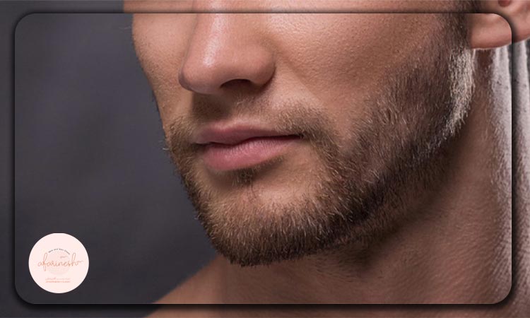 مشکلات کاشت ریش قبل از ۲۵ سالگی
