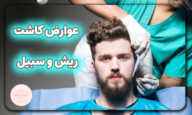 عوارض کاشت ریش و سبیل