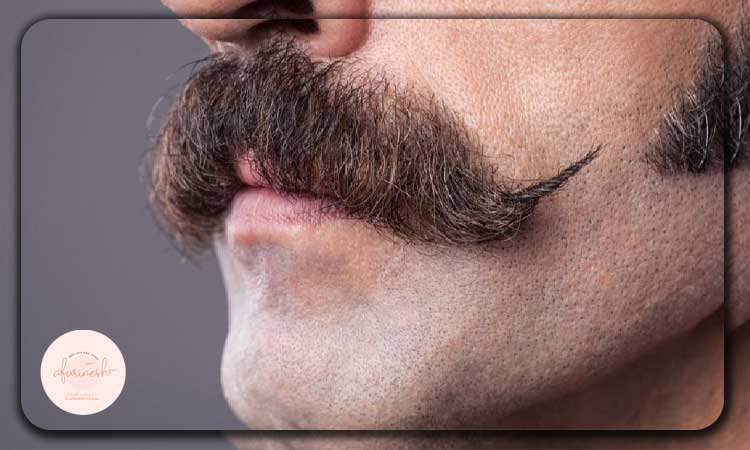 قیمت کاشت سبیل به تنهایی