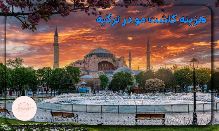 هزینه کاشت مو در ترکیه