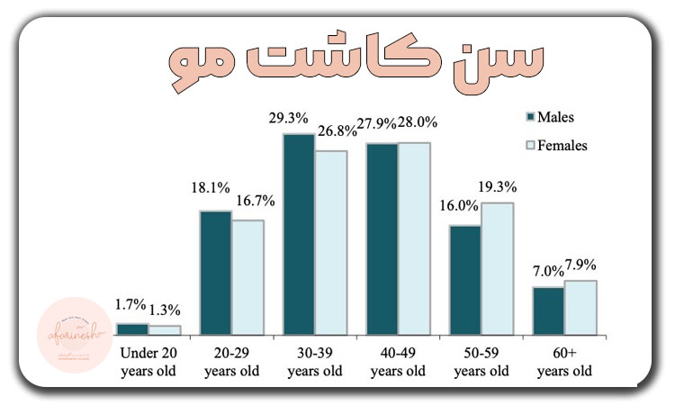 سن کاشت مو
