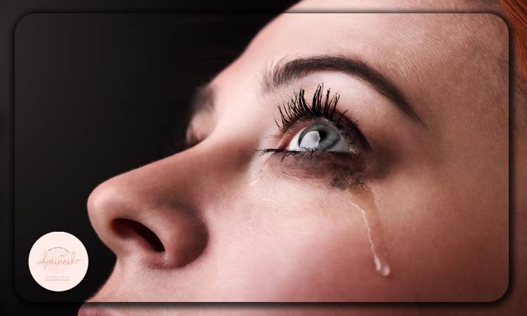 راهکارهای کاهش میل به گریه بعد از بلفاروپلاستی