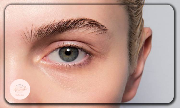 تاثیر کم کاری تیروئید بر کاشت ابرو