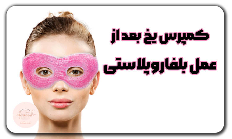 کمپرس یخ بعد از عمل بلفاروپلاستی