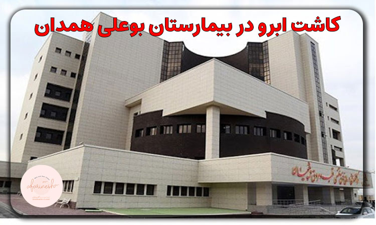 کاشت ابرو در بیمارستان بوعلی همدان