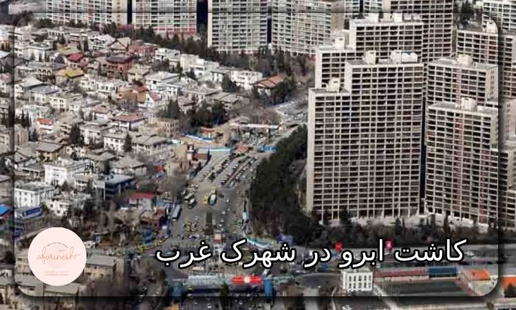 کاشت ابرو در شهرک غرب