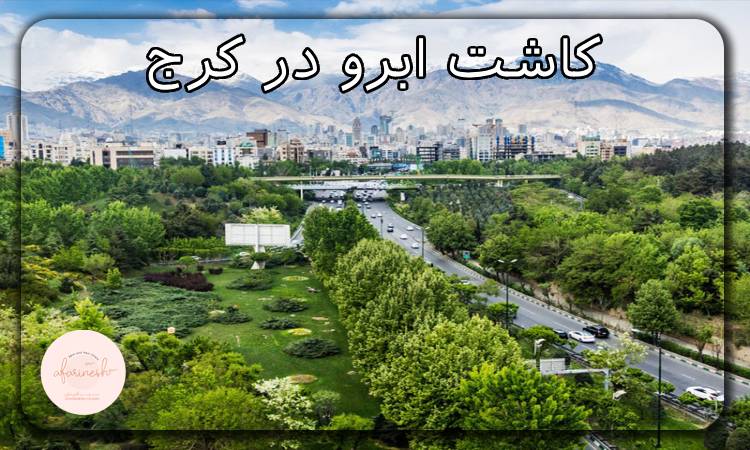 بهترین دکتر کاشت ابرو در کرج