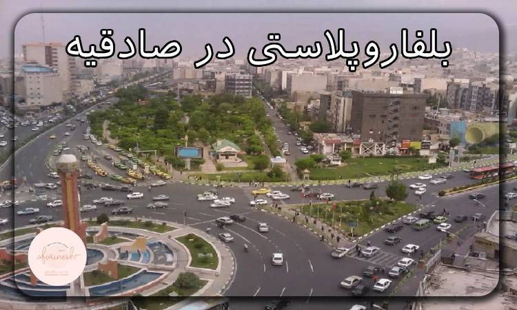 بلفاروپلاستی در صادقیه