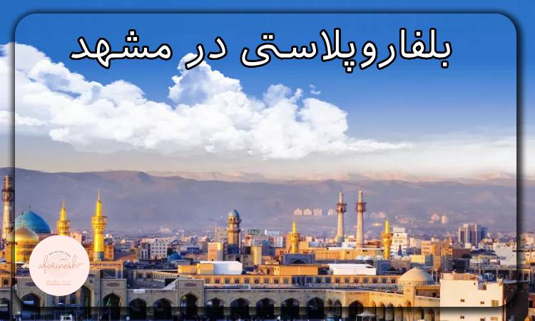 بلفاروپلاستی در مشهد