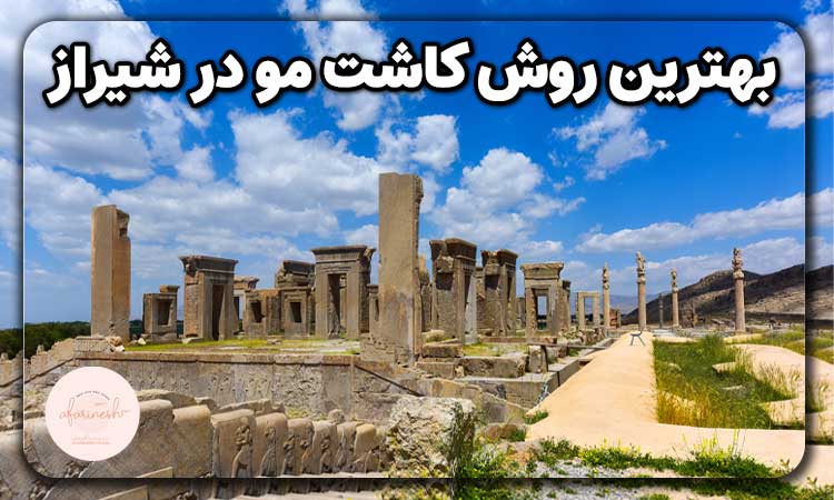 بهترین روش کاشت مو در شیراز