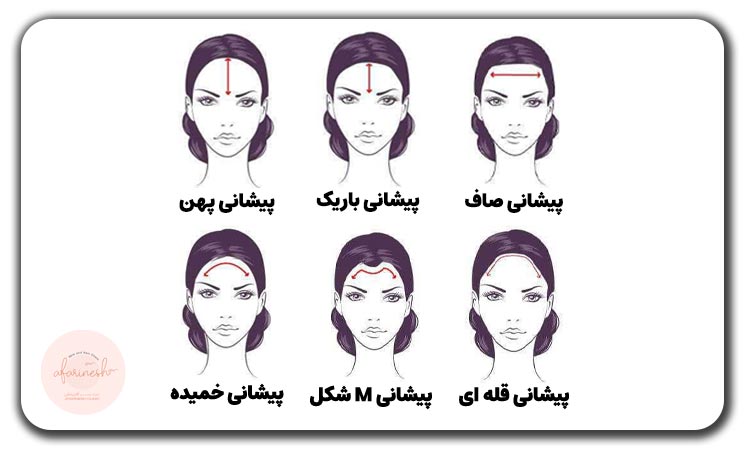 خط رویش طبیعی مو به چه شکل است؟