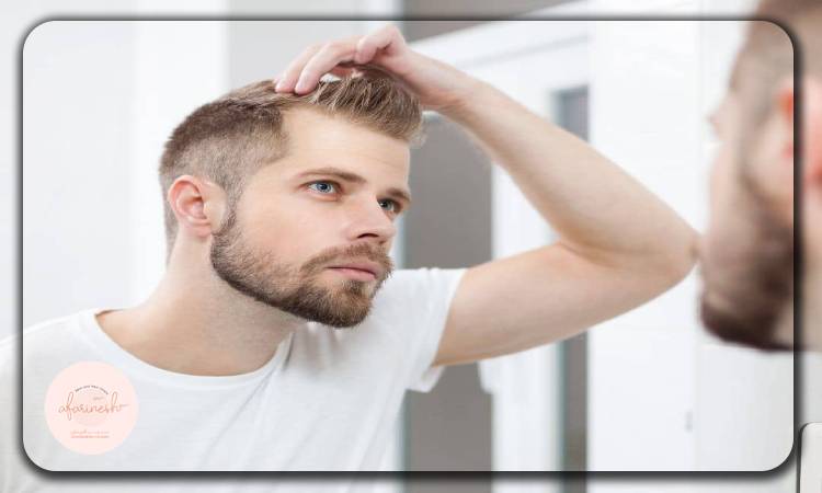 ظاهر غیر طبیعی موهای کاشته شده