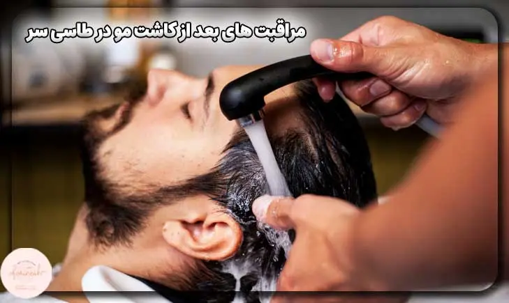 مراقبت های بعد از کاشت مو در طاسی سر