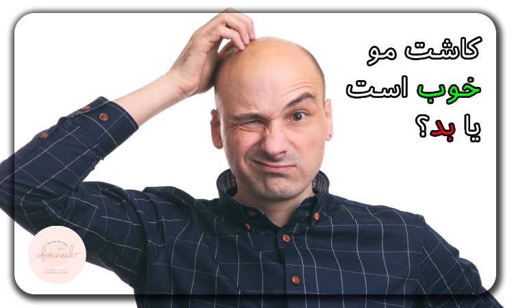 کاشت مو خوب است یا بد؟