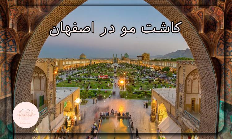 کاشت مو در اصفهان