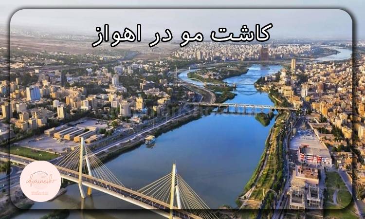 کاشت مو اهواز