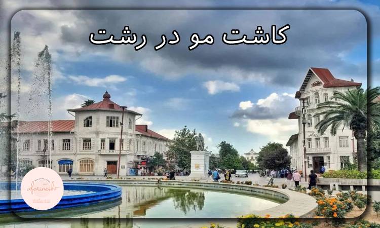 کاشت مو در رشت