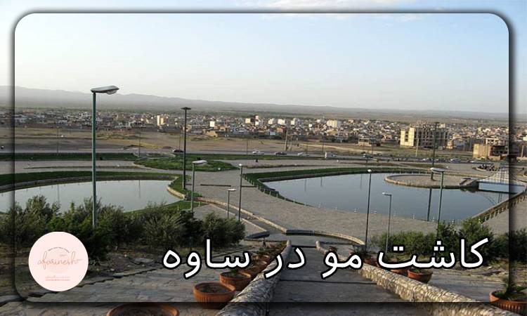 کاشت مو در ساوه