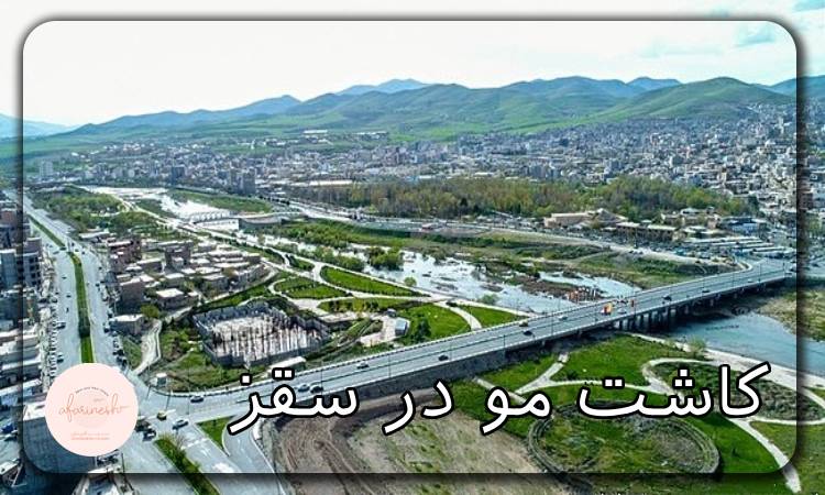کاشت مو در سقز