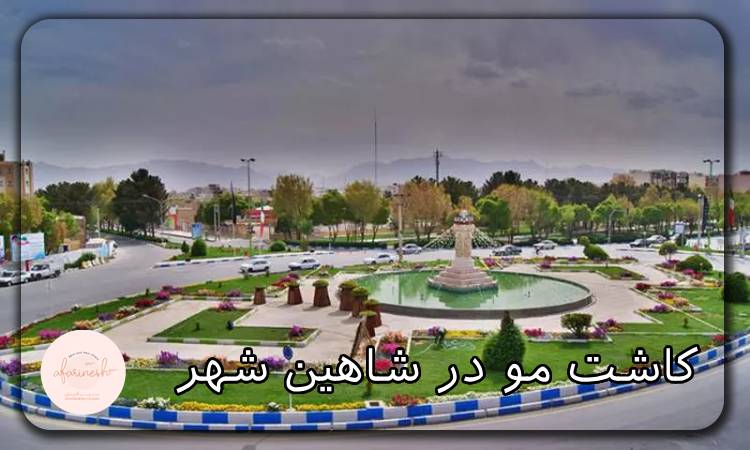 کاشت مو در شاهین شهر
