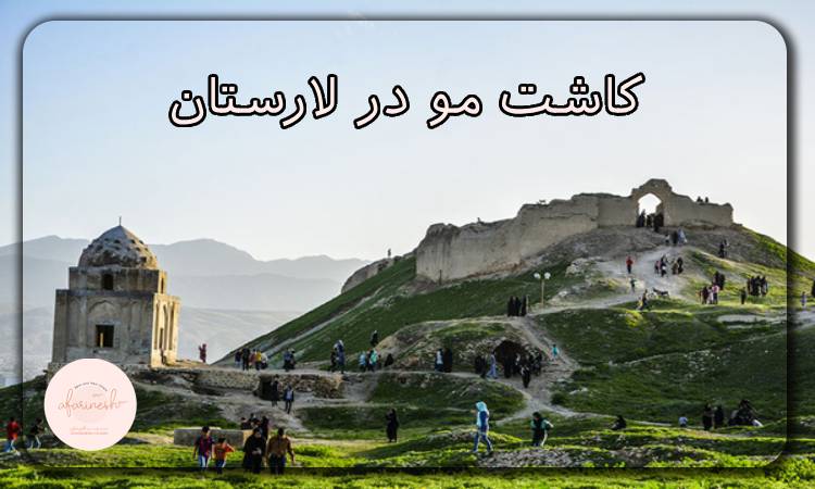 کاشت مو در لارستان