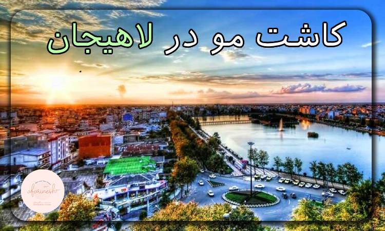 کاشت مو در لاهیجان