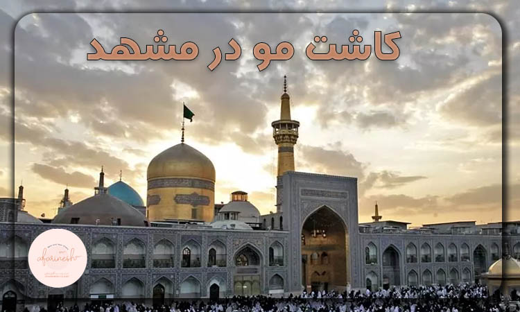 کاشت مو در مشهد