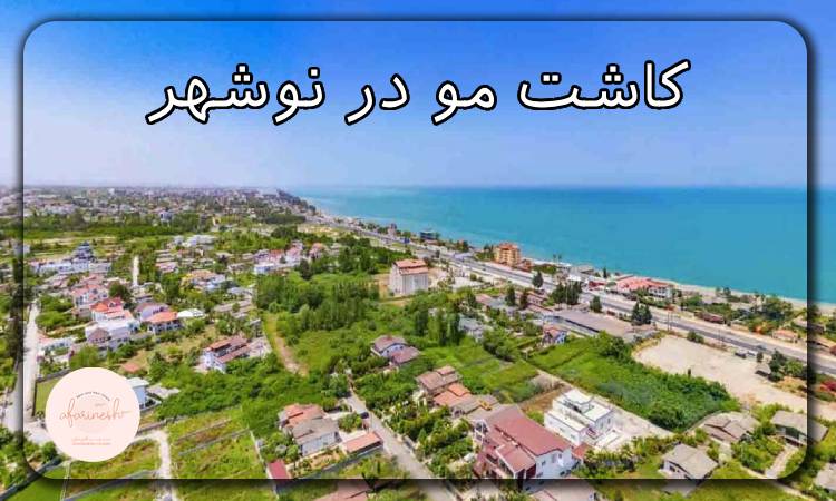 کاشت مو در نوشهر
