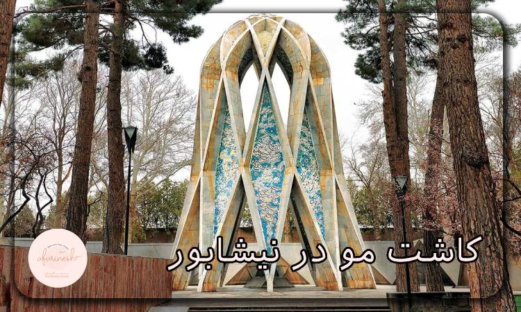 کاشت مو در نیشابور