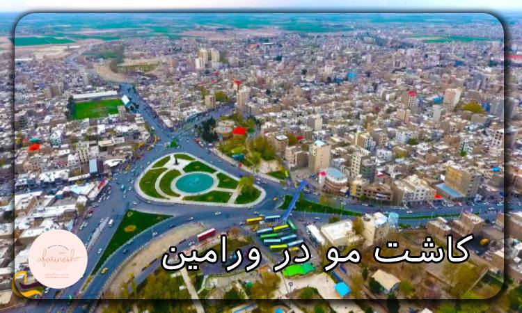 کاشت مو در ورامین