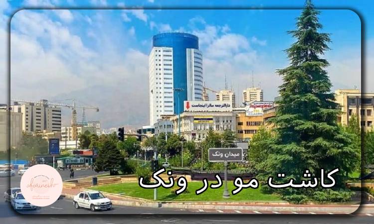 کاشت مو در ونک