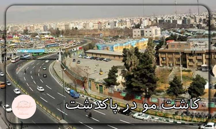 کاشت مو در پاکدشت