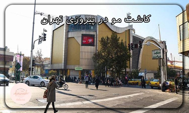 کاشت مو در پیروزی تهران