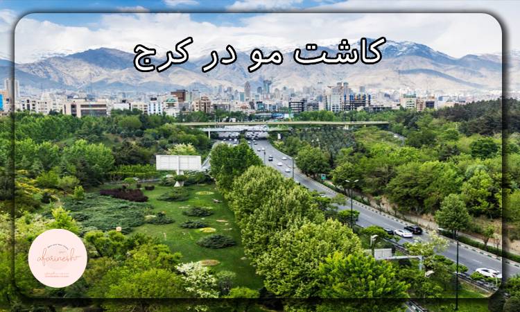کاشت مو در کرج