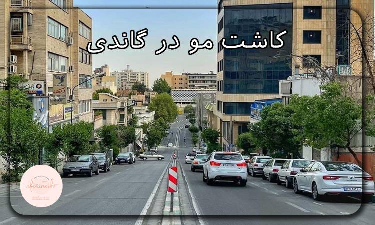 کاشت مو گاندی