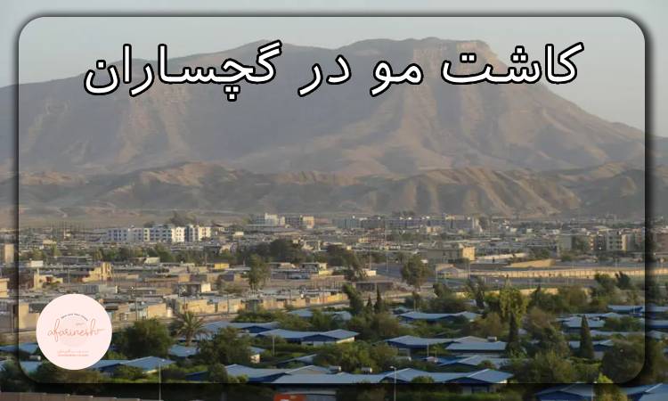 کاشت مو در گچساران