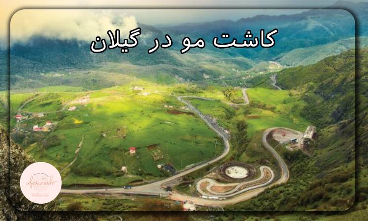 کاشت مو در گیلان