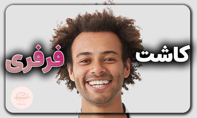 کاشت مو فر