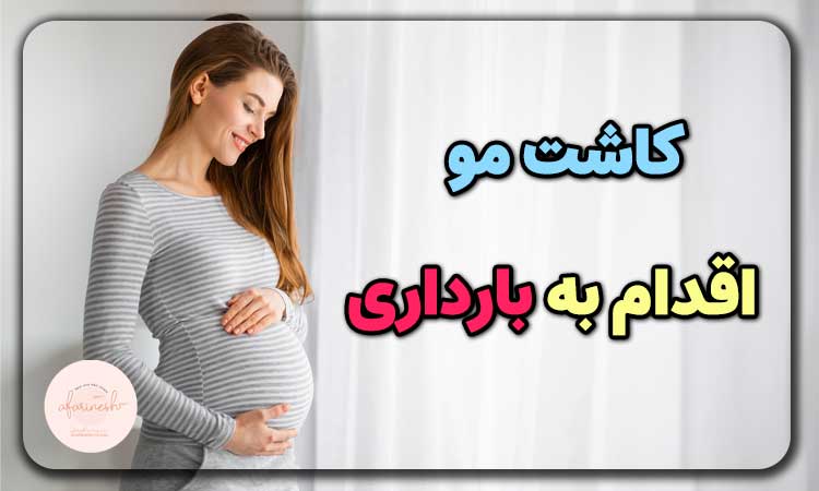 کاشت مو و اقدام به بارداری