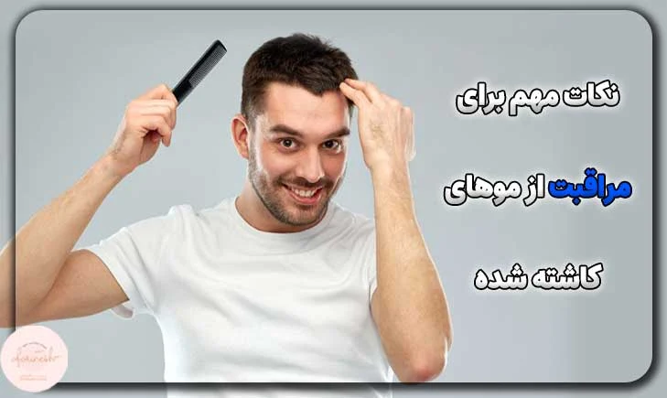 نکات مهم برای مراقبت از موهای کاشته شده