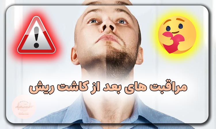 مراقبت های بعد از کاشت ریش
