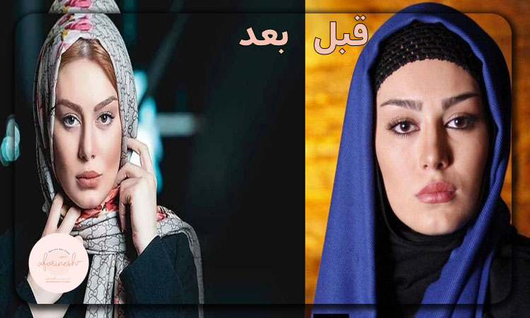 تصویر قبل و بعد کاشت ابرو سحر قریشی