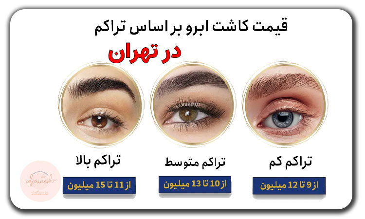 هزینه کاشت ابرو در تهران