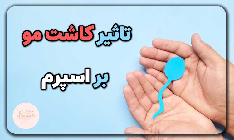 تاثیر کاشت مو بر اسپرم