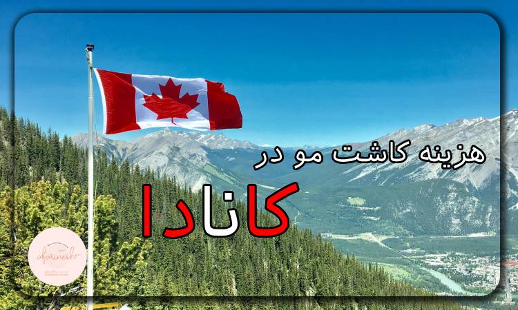 هزینه کاشت مو در کانادا
