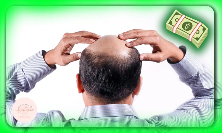 هزینه کاشت مو وسط سر